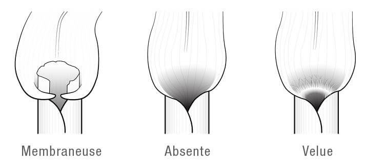 Types de ligules des graminées.