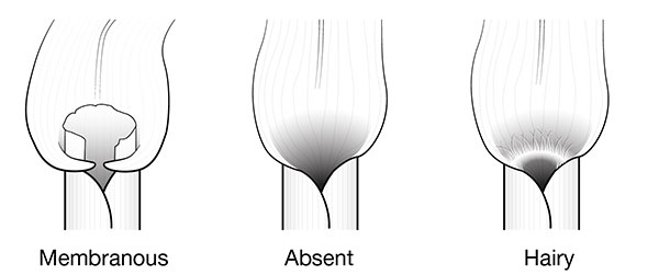 Grass ligule types. 